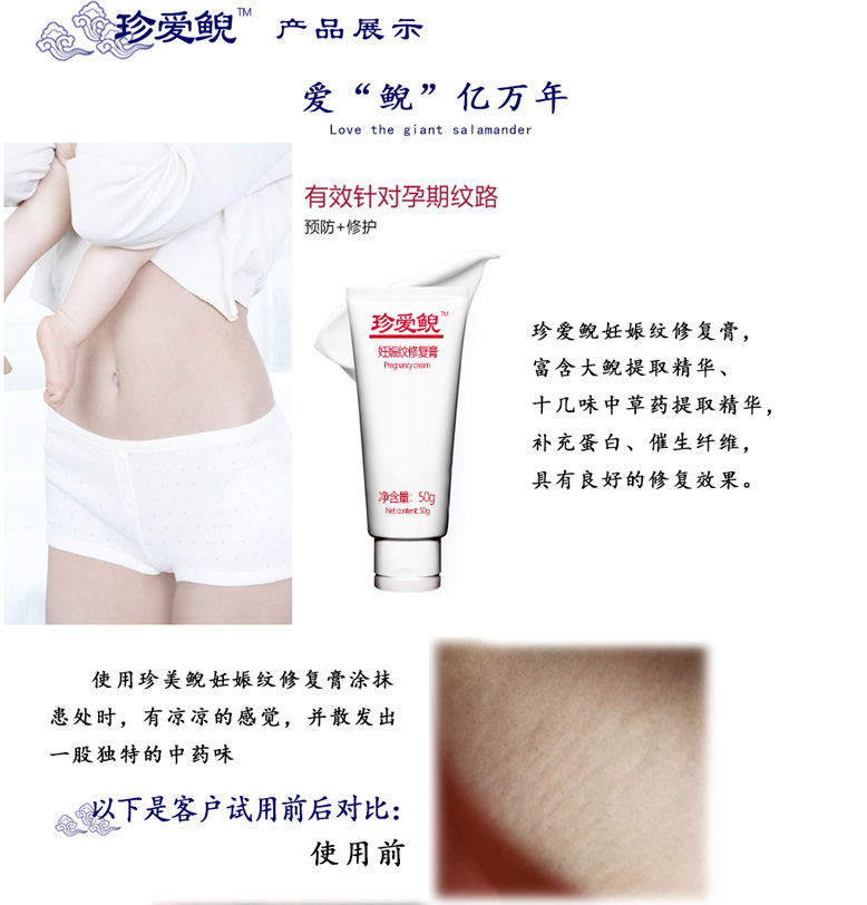 妊娠纹修复膏778_04.jpg
