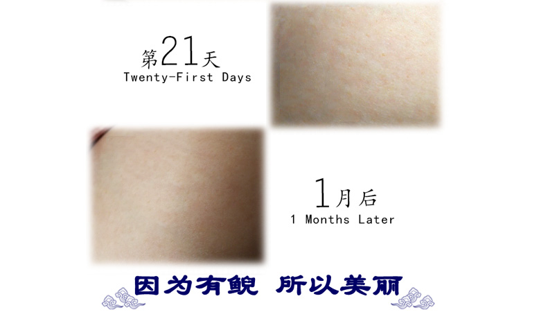 妊娠纹修复膏778_06.jpg